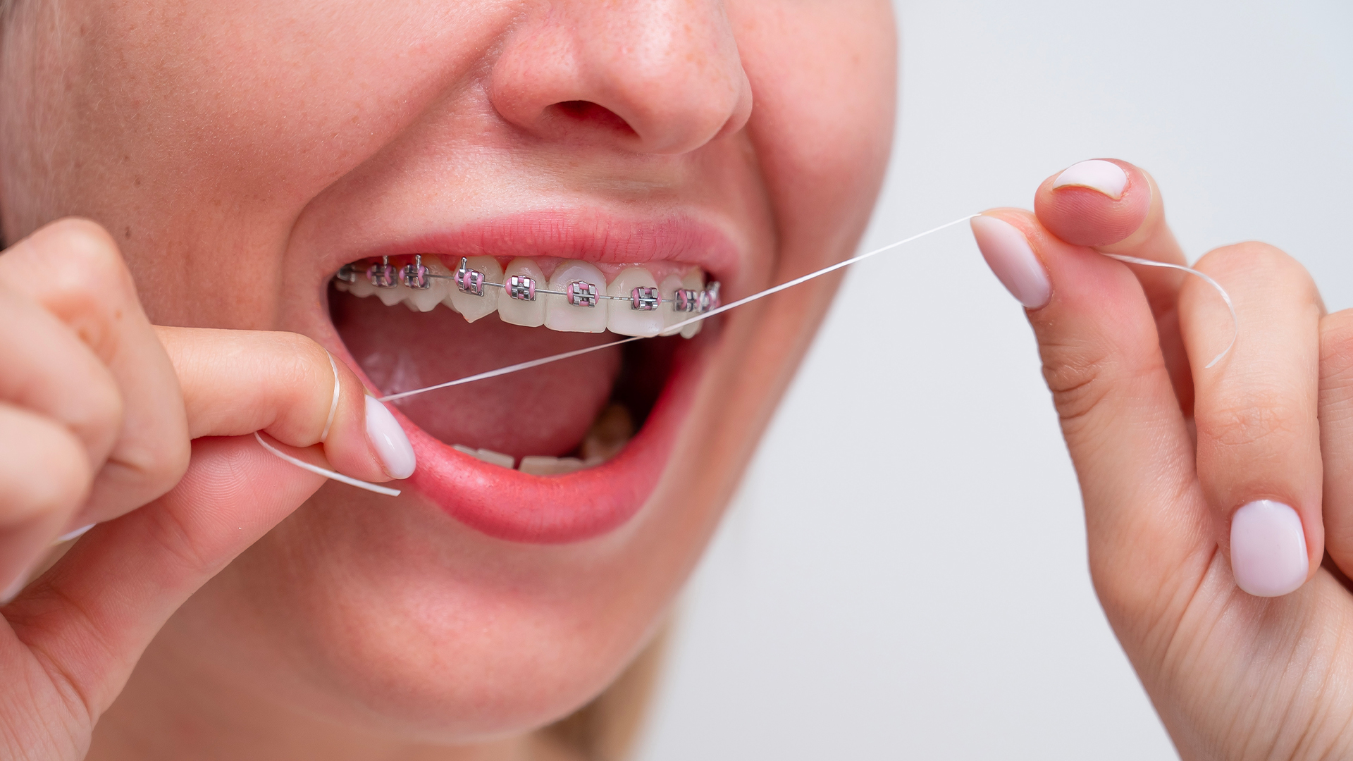 ragazza mostra come lavare i denti con l’apparecchio